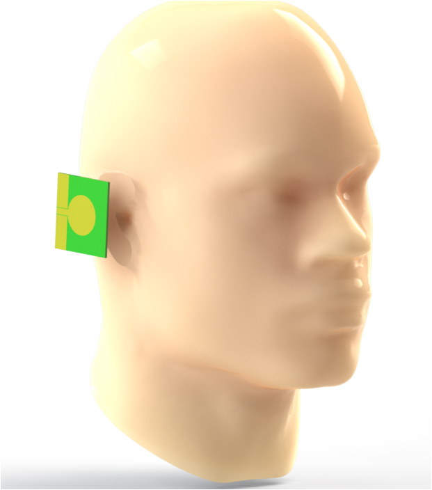 3D model of human head exposed to UMTS antenna radiation
