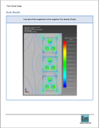 Analysis of a 3 phases system