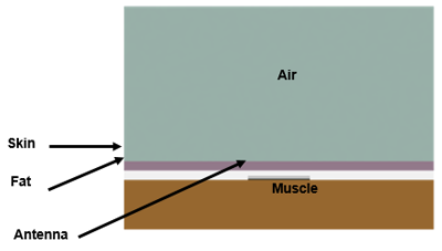 Antenna in Three Tissue Layers