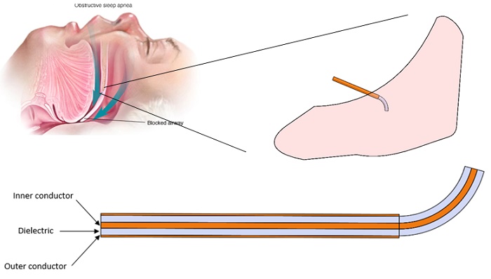 Soft Palate model with the open-tip antenna