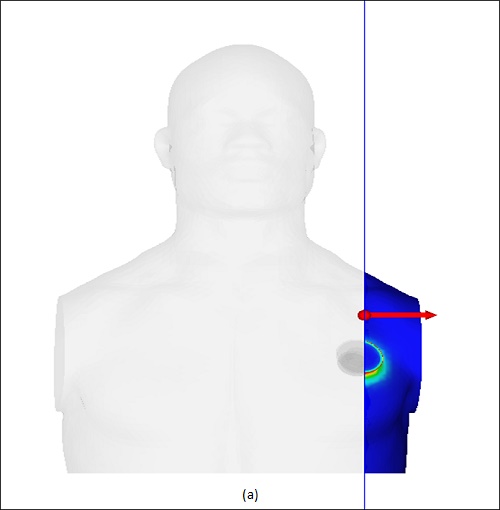 : Querschnittsansicht der magnetischen Flussdichteverteilung; a) Vorderansicht, b) Isometrische Ansicht