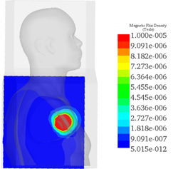Magnetic Flux Density Distributions with and without Shielding across Human Body
