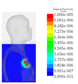 Magnetic Flux Density Distributions with and without Shielding across Human Body