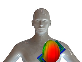 Optimizing Implantable Antennas for Wireless Biotelemetry Systems